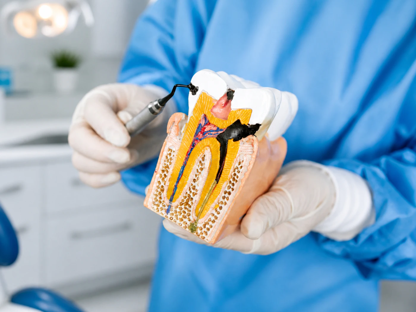 A dentist holding a cutaway model of a tooth to explain a filling